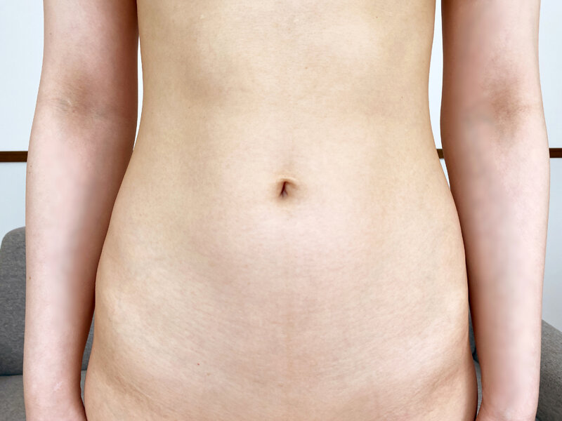 SSR-18 thumb image 6