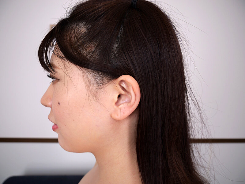 SSR-28 thumb image 5